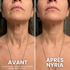 Crème Raffermissante cou