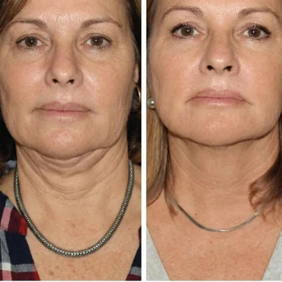 Transformation visible du visage et du cou