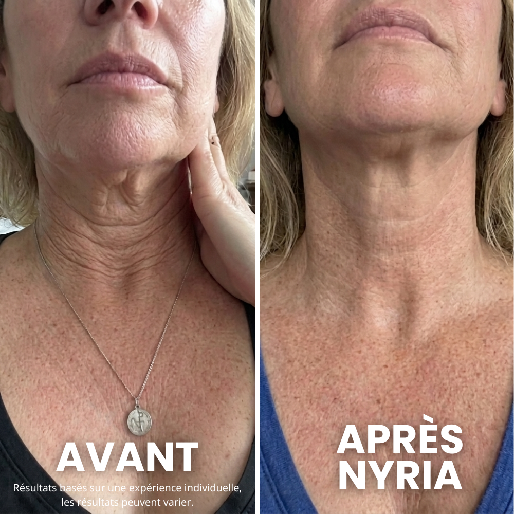 Crème Raffermissante cou