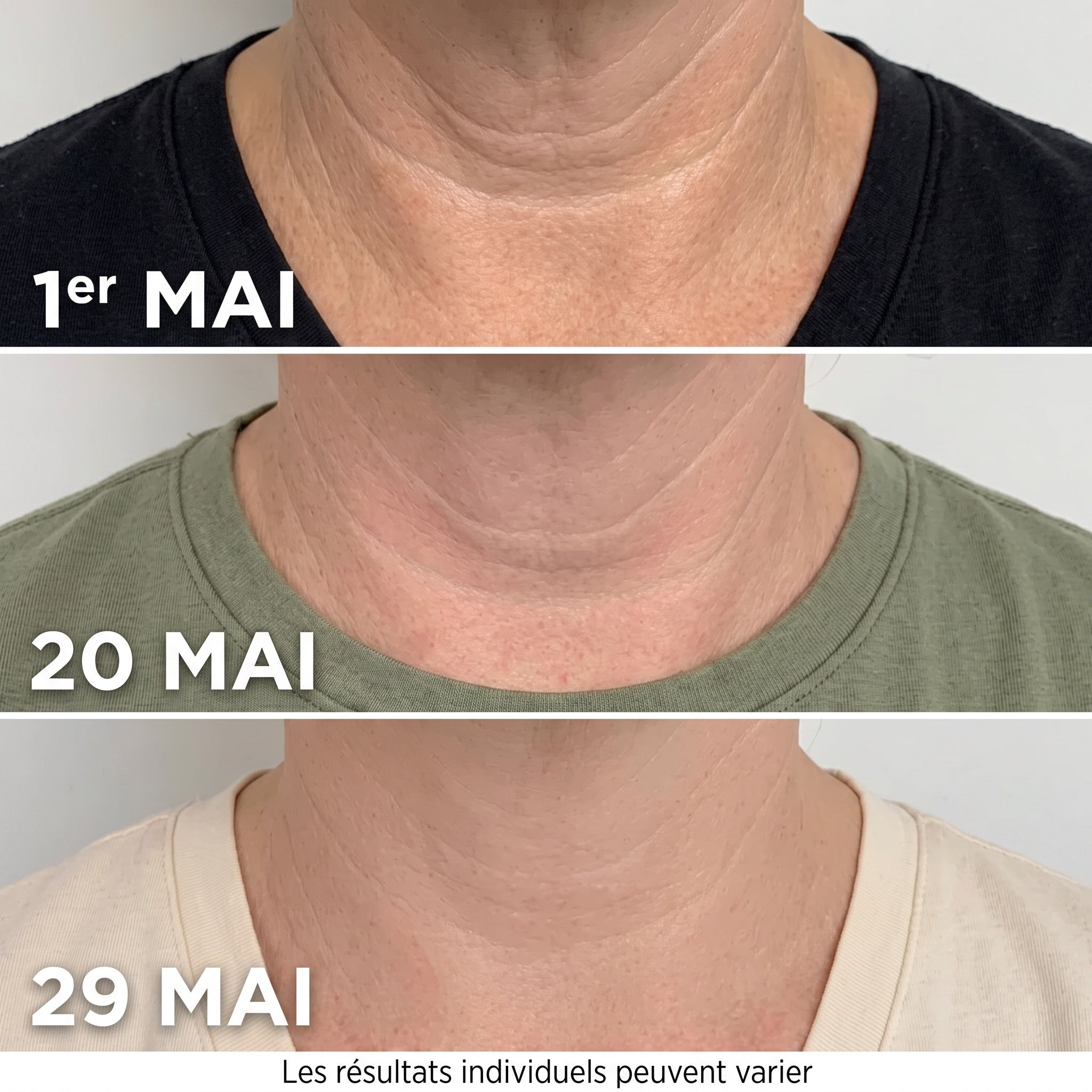 Avant après semaine 4